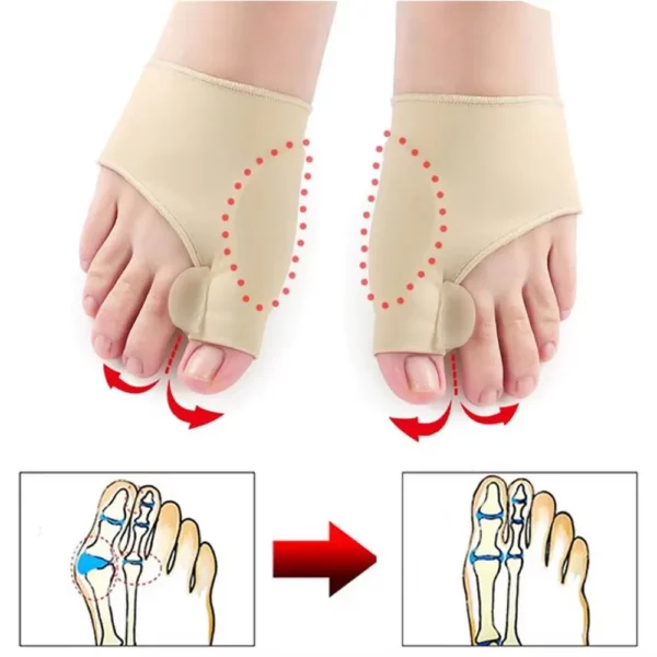 1 Paar Teen Separator Hallux Valgus Bunion Corrector Hamer Teen Stijltang Voet Pijnbestrijding Orthopedische Pedicure Gereedschap Voetverzorging